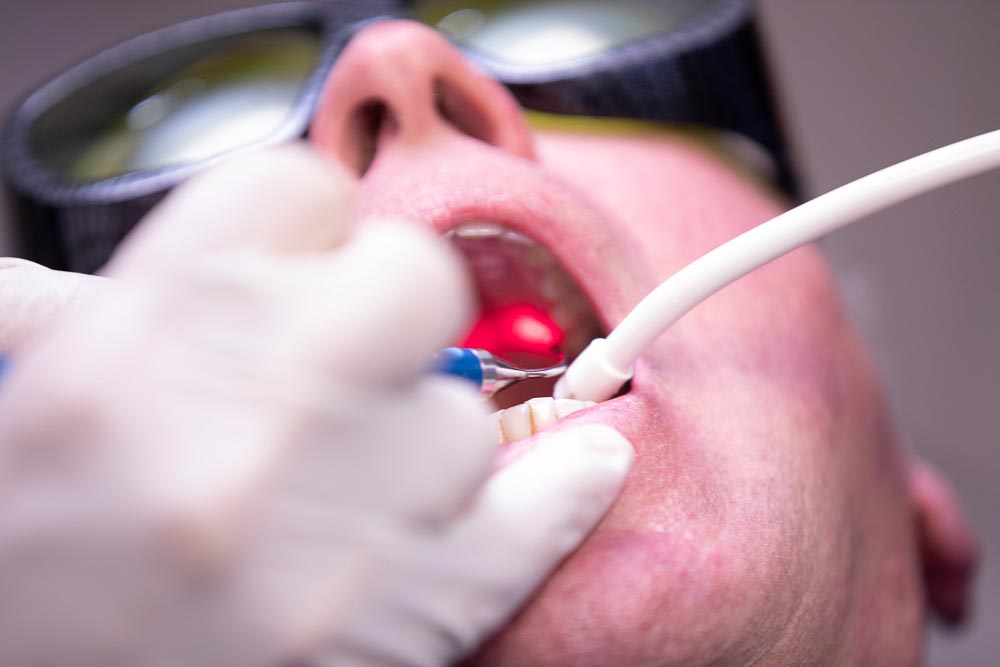 a dental patient being treated with the LAPIP laser