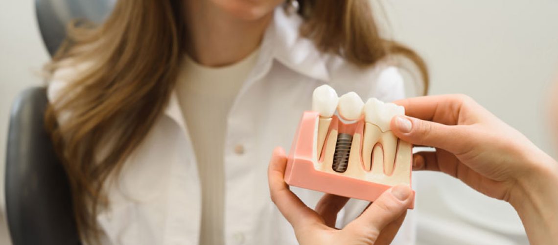 Dental Patient Getting Shown A Dental Implant Model During Her Consultation in Falls Church, VA